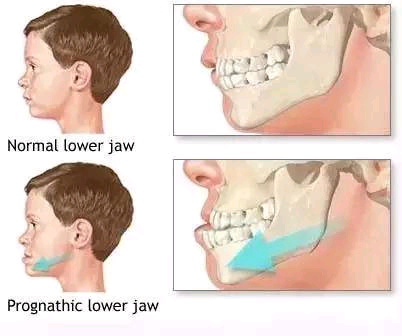 Ӱ-ʲôCXҪrg