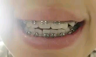 Ӱ-ʲôCXҪrg